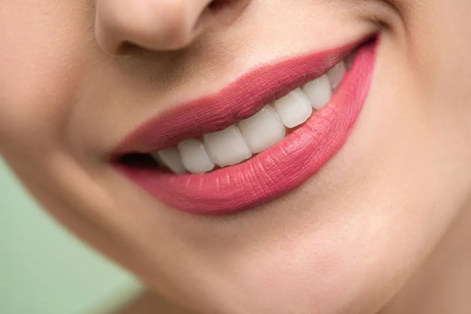Después